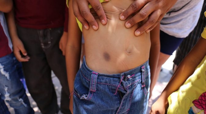 Durango: En Lerdo, denuncian que niños tienen infecciones por agua sucia (Milenio)