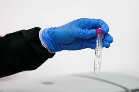 España: Experto afirma que las aguas residuales son “grandes aliadas” contra el coronavirus (EFE Verde)