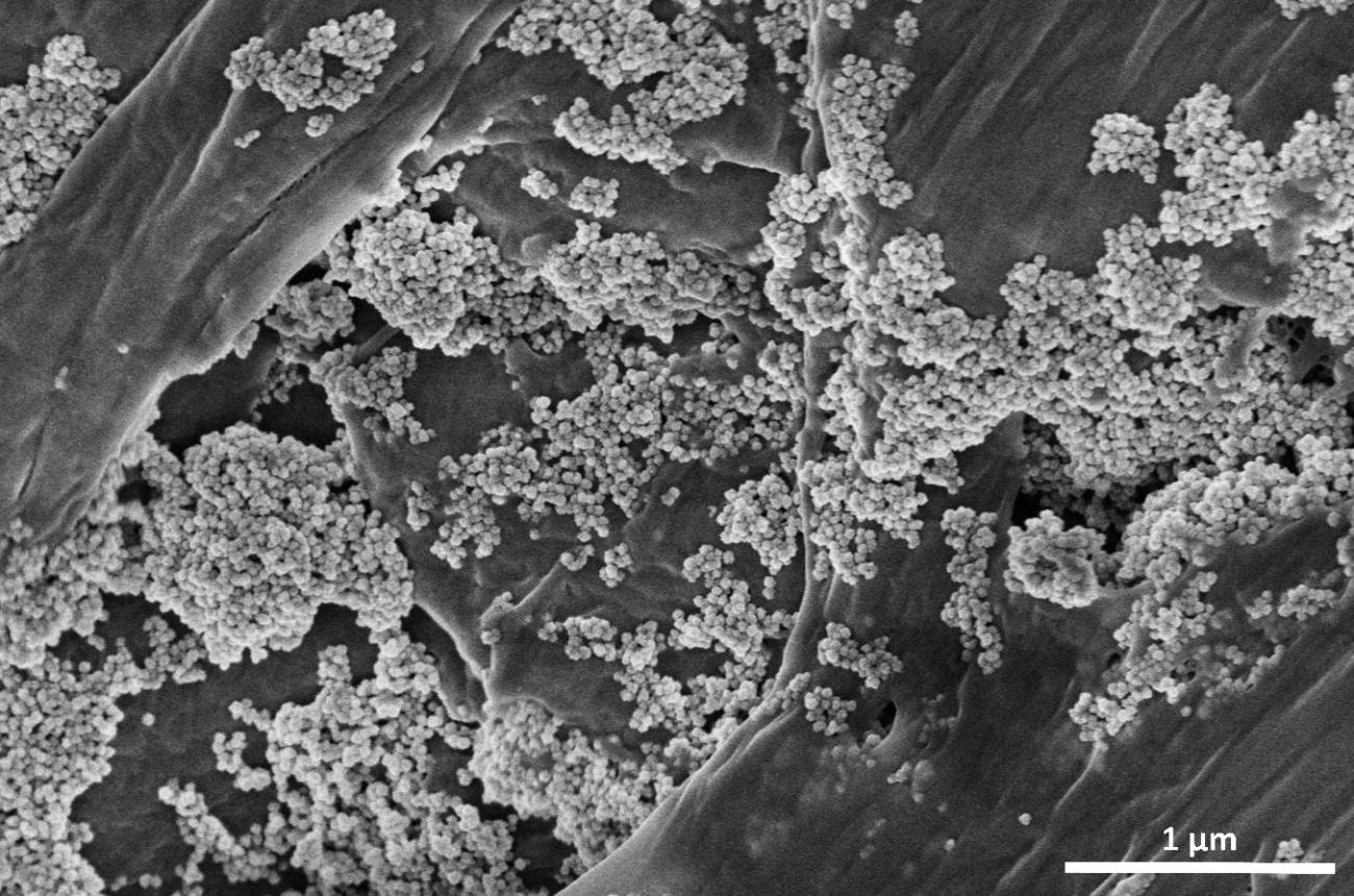 Internacional – Eliminan microplásticos del agua con nanoflores de óxido de hierro (Agencia Sinc)