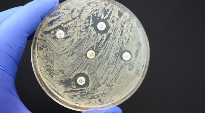 Mundo-Europa actúa cuando el agua llega al cuello con las resistencias (El Global)